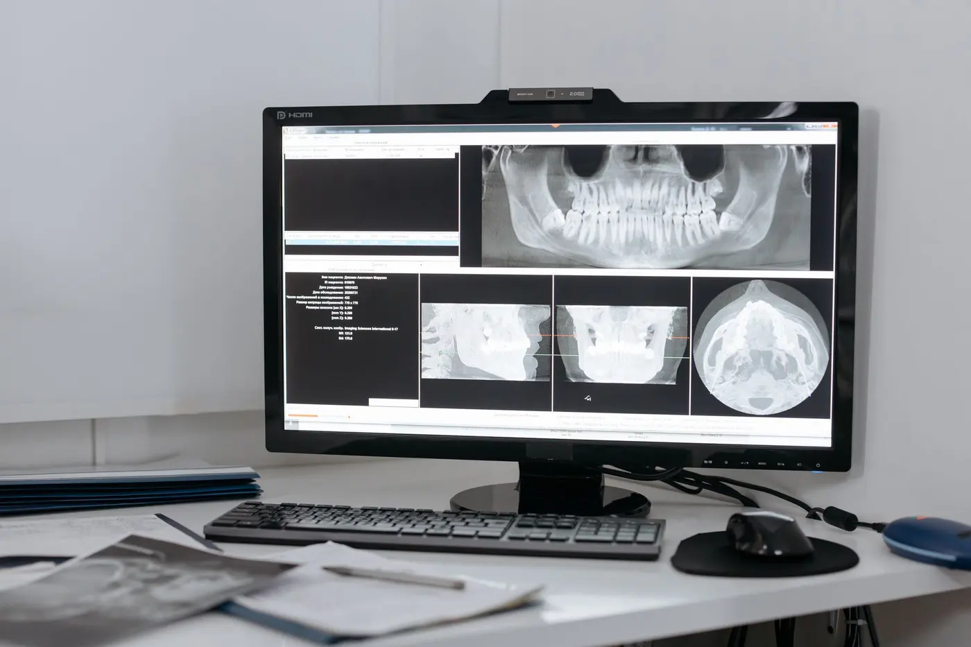 Modern dental clinic with technology and computer screens